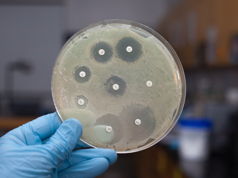 Extensively drugresistant tuberculosis pathogen develops further